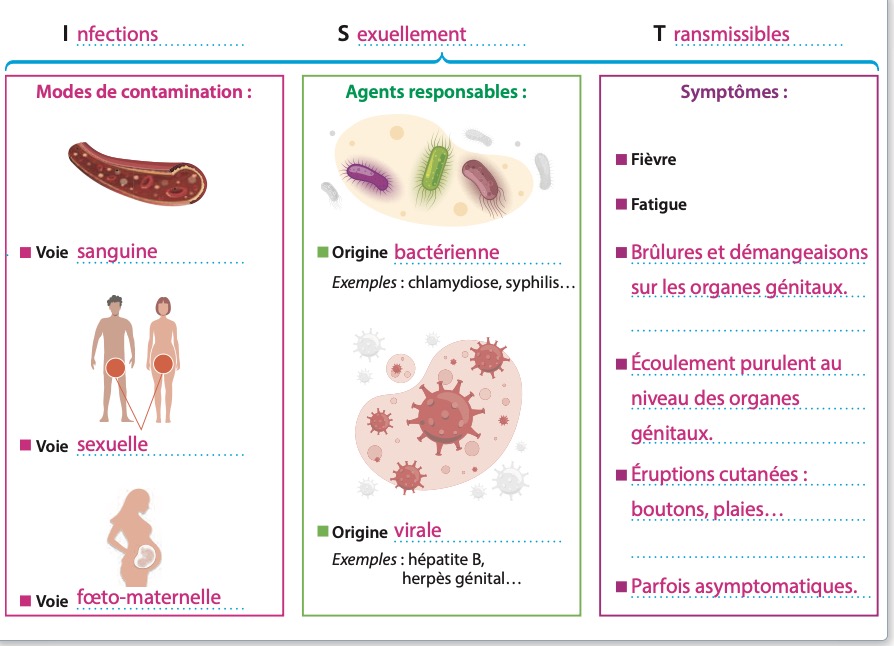 Document A – Les IST